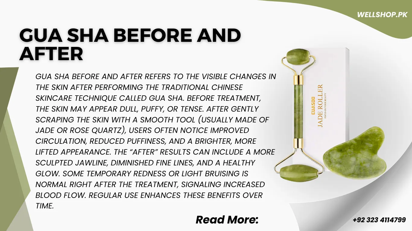 Gua Sha Before and After