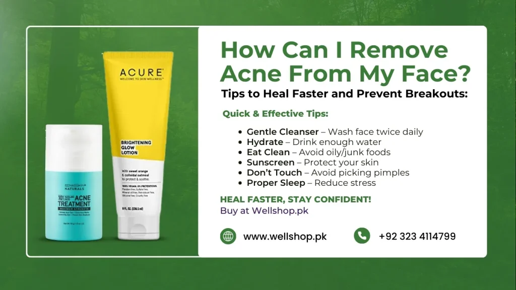 How Can I Remove Acne From My Face