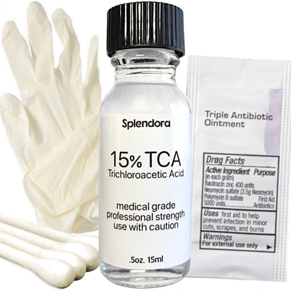 15% TCA Acid Skin Peel Kit 5 Ounce  15ml Professional Grade Acid