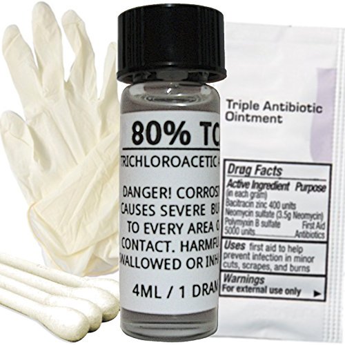 80% TCA Skin Peel Kit - Acid Peel - Age Spots, Stretch Marks, Acne Scars, Scars, Hyperpigmentation, Wrinkles & Freckles