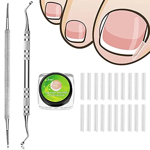 Ingrown Toenail Corrector,50 PCS Ingrown toenail Correction treatment Kit, Toenail Corrector Straightener Strips Recover Clips with 2 PCS Ingrown Toenail File And Lifter